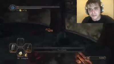 This area gives me CONIPTIONS