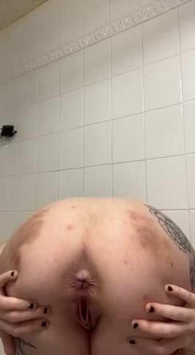 The bruises are from a BDSM party I went to, don’t worry ;)