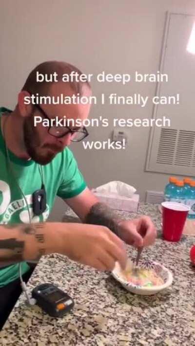 Deep brain stimulation for relieving Parkinson's. This technology is helping millions of people with the disease to properly eat