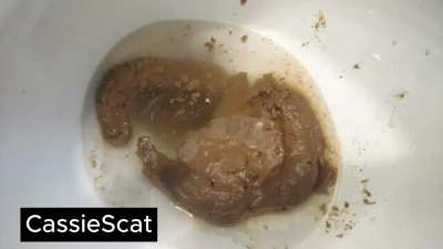 Second Time with Laxatives: Toilet, Sink, Trash Can