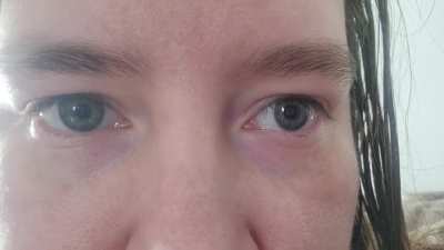 When I relax my eyes my left eye wanders