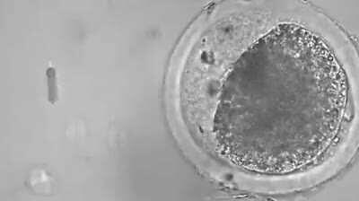 A nanobot performs artificial insemination of an egg