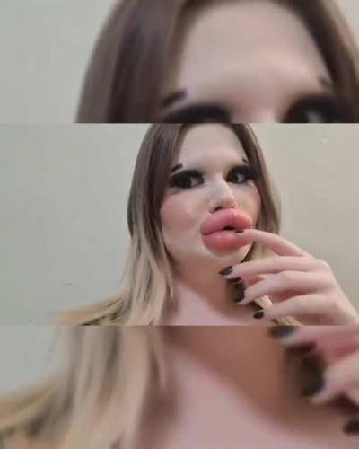Woman with world’s biggest lips wants more filler despite “fans” fearing they’ll burst.