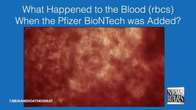 Pfizer under the microscope