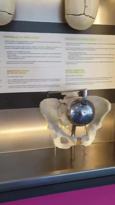 The difference between a male and female pelvis