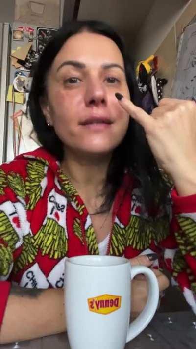 Yikes, Cristina Scabbia burned her face cooking