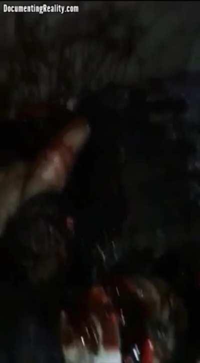 Woman left severely disfigured after husband attacks her with machete.