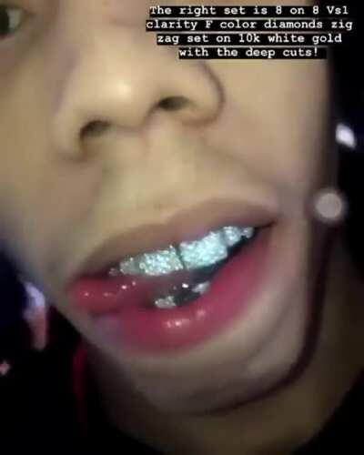 What's yall thoughts on the new grill my boy just copped 😁