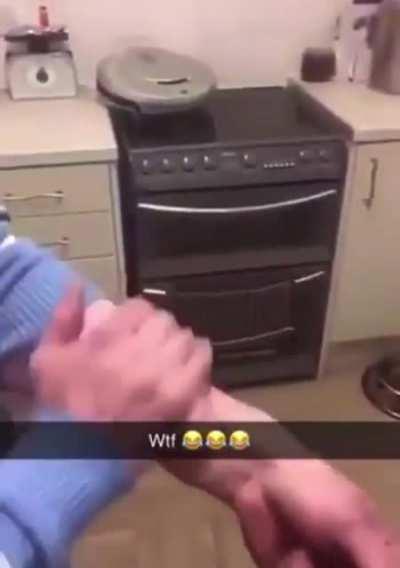 Man has penis surgically attached to his arm.