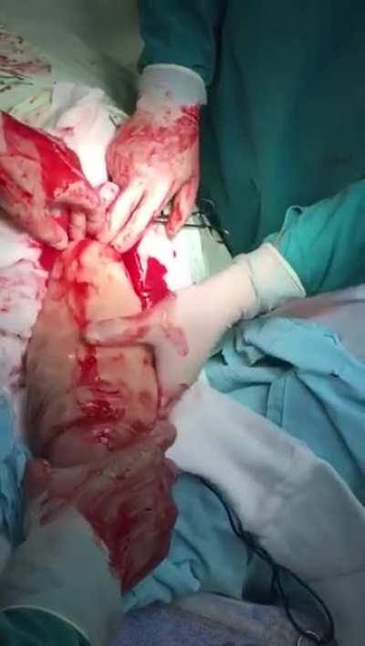 Remove Absolute Massive Toy after getting stuck up