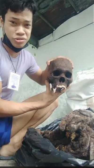 guy does an unboxing of his brother's bones live on facebook