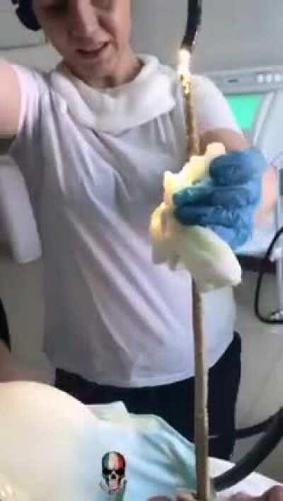 Wonder how it got that far in the first place