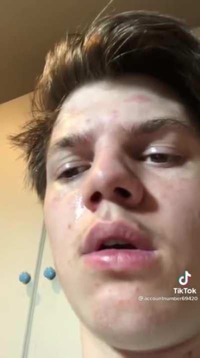 r/animehate in a nutshell