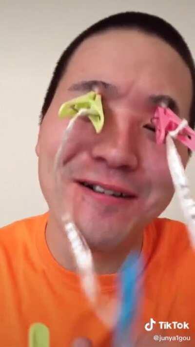 I forgot what those are called