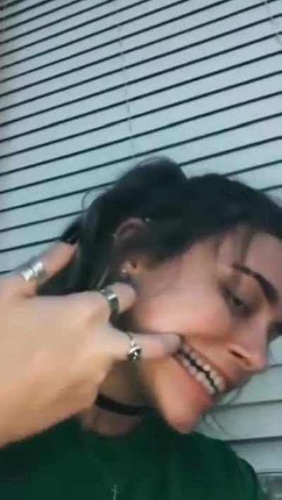 Girl got some of those venom genes