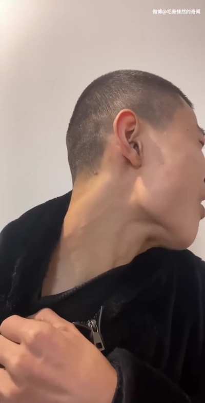 I've been mewing for 20 years