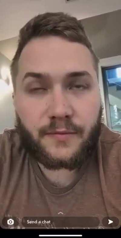 🇺🇸 🇬🇧🇺🇦 🇷🇺 A British mercenary who joined the Georgian Territorial Defense Legion complains about the huge losses among the British and Americans as a result of the strike on their base, as well as the attitude of the Ukrainians towards them: they wanted 