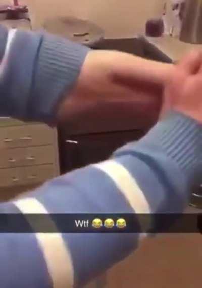 Man has a penis surgically attached to his arm. OP: u/thewhackcat