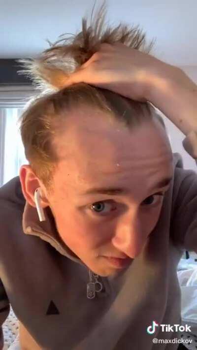 Hairline can destroy everything.