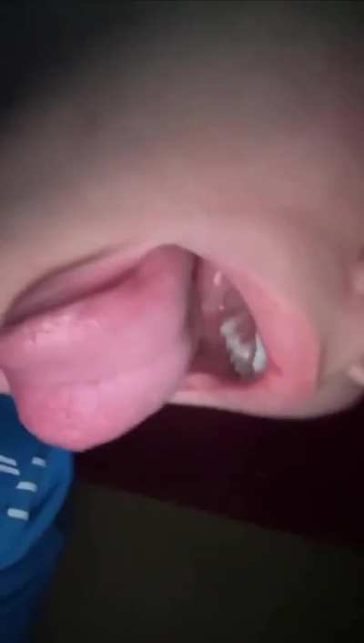 Beautiful Italian girl with braces video