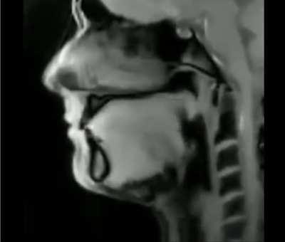 Live MRI of a Person Talking