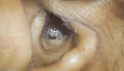 This spider in an ear