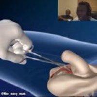 Found this on Discord.