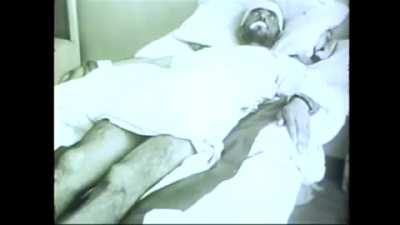 Rabies in a human patient — a video showcasing the progression of the deadly virus in a young man before he ultimately dies