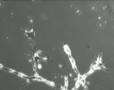 These are neurons trying to connect. Your memories, your dreams, everything you know about the universe is thanks to these little guys and how they interact