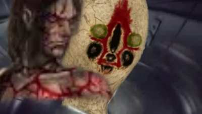 Stomach ache 173 Demo