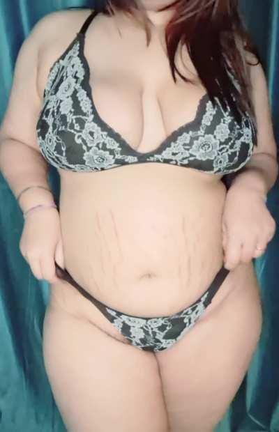 How do you feel about stretch marks?