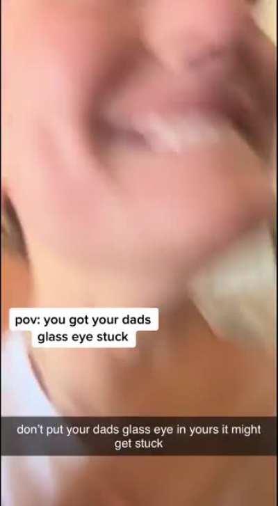 Oopsie (Excuse the music)