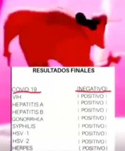 Orson Despues De Yo Interneto 🌿🤑