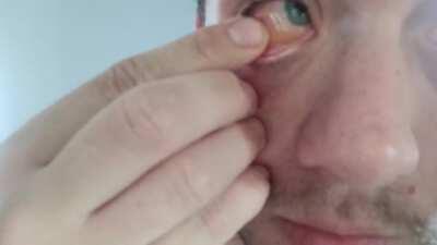 I think my allergies are playing up guys.