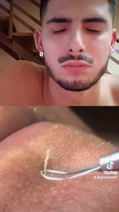 Yummy infection pasta