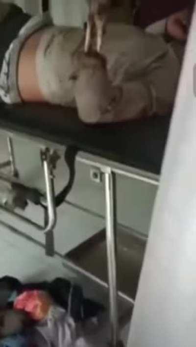 Fried To The Bone By Electricity (WARNING: VERY GRAPHIC CONTENT)