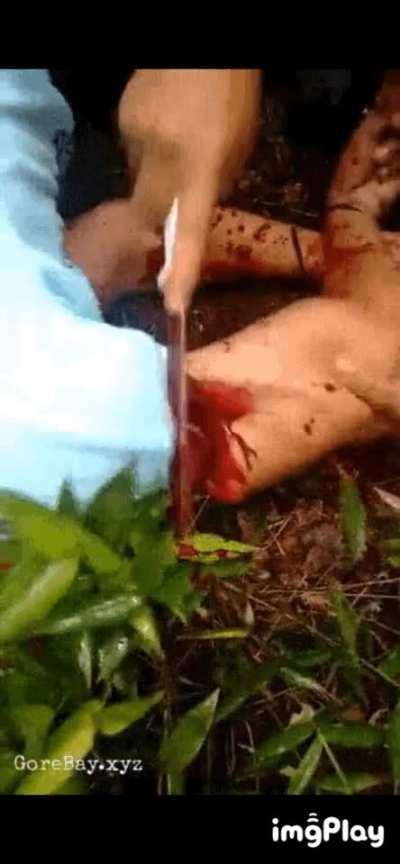 A man get his arm cut