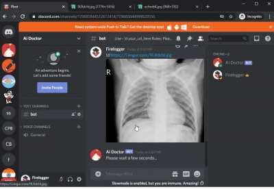 I made a Discord bot that detects diseases using X-ray scans