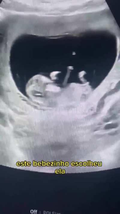 Pessoas que tiveram um dia pior que o seu