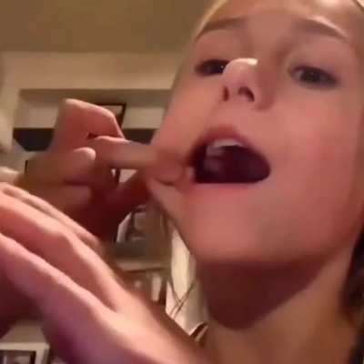 How to take your teeth out