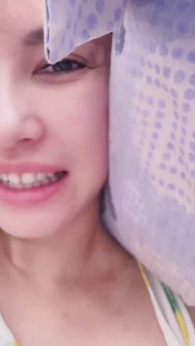 She got IV transfusions last week, she came back to say she is fine