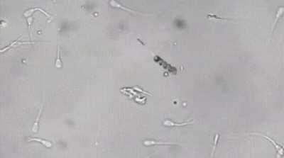 A nanobot picks up a lazy sperm by the fail and inseminates an egg with it