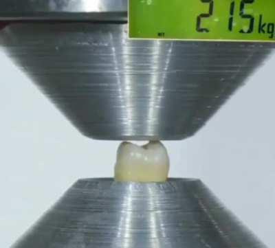 Hydraulic press on a wisdom tooth