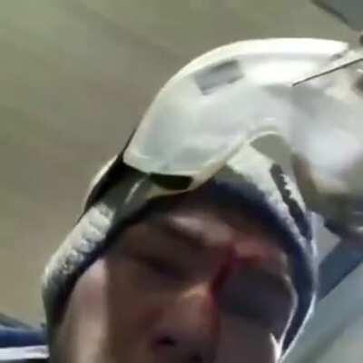 Imagine the damage without the safety glasses