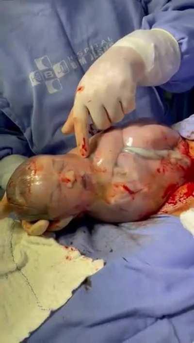 The pager waking me up at 2am because apparently the comatose patient urgently needs his medication orders renewed