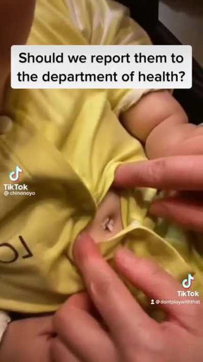 Might be a violation of code @chinonoyo