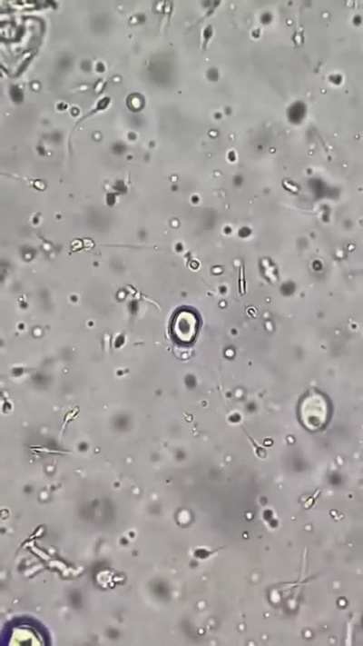 This is what semen looks like under the microscope