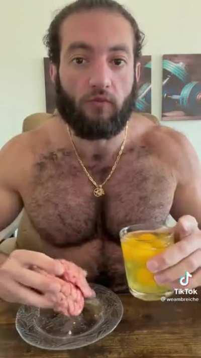 prion disease 💪💪💪