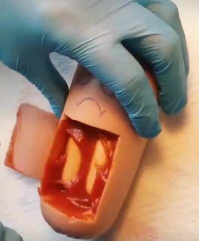 Thanks I hate twin sausages!