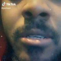 Surprise bear attack